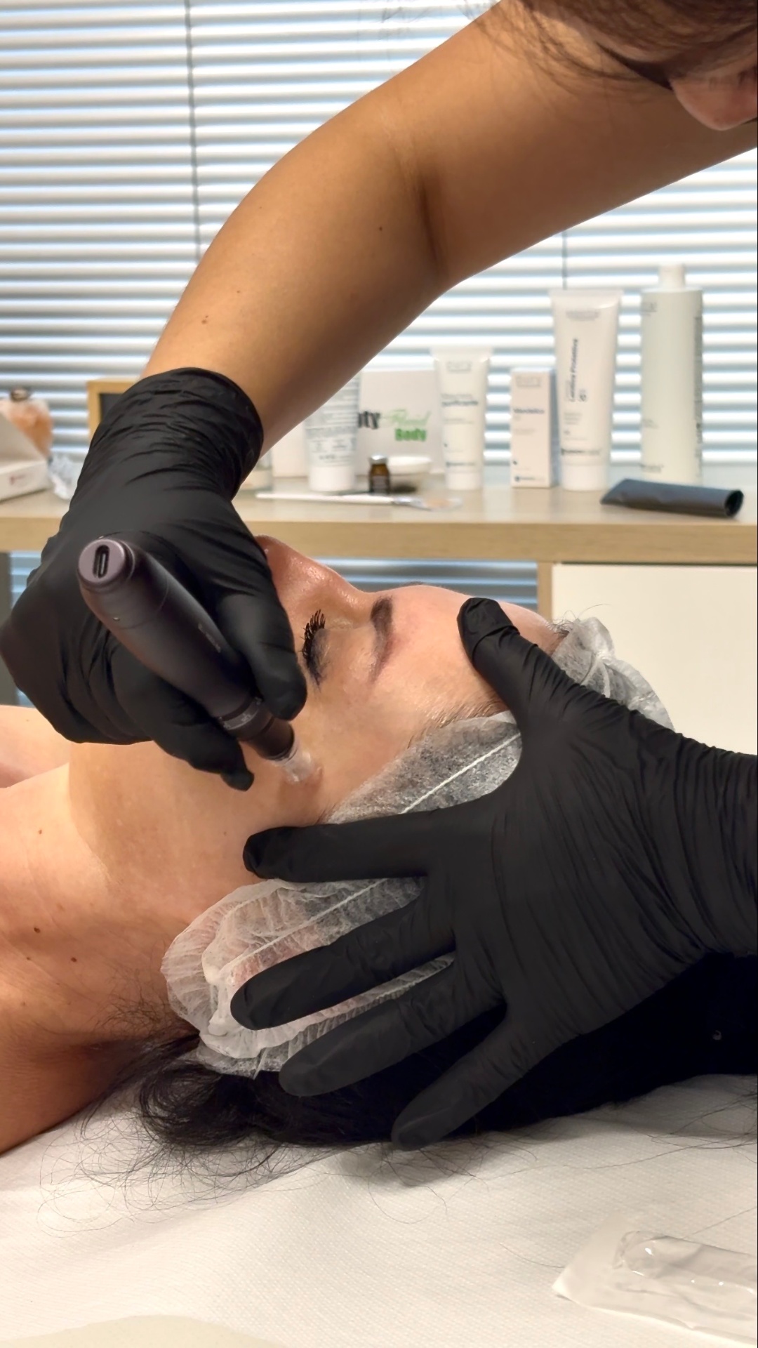 Trattamento Needling viso in cabina — Reverse Beauty Experience